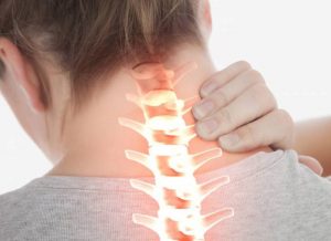 درمان درد دیسک گردن با روش های غیرجراحی